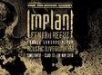 concert implant pentru refuz