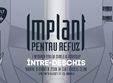 concert implant pentru refuz